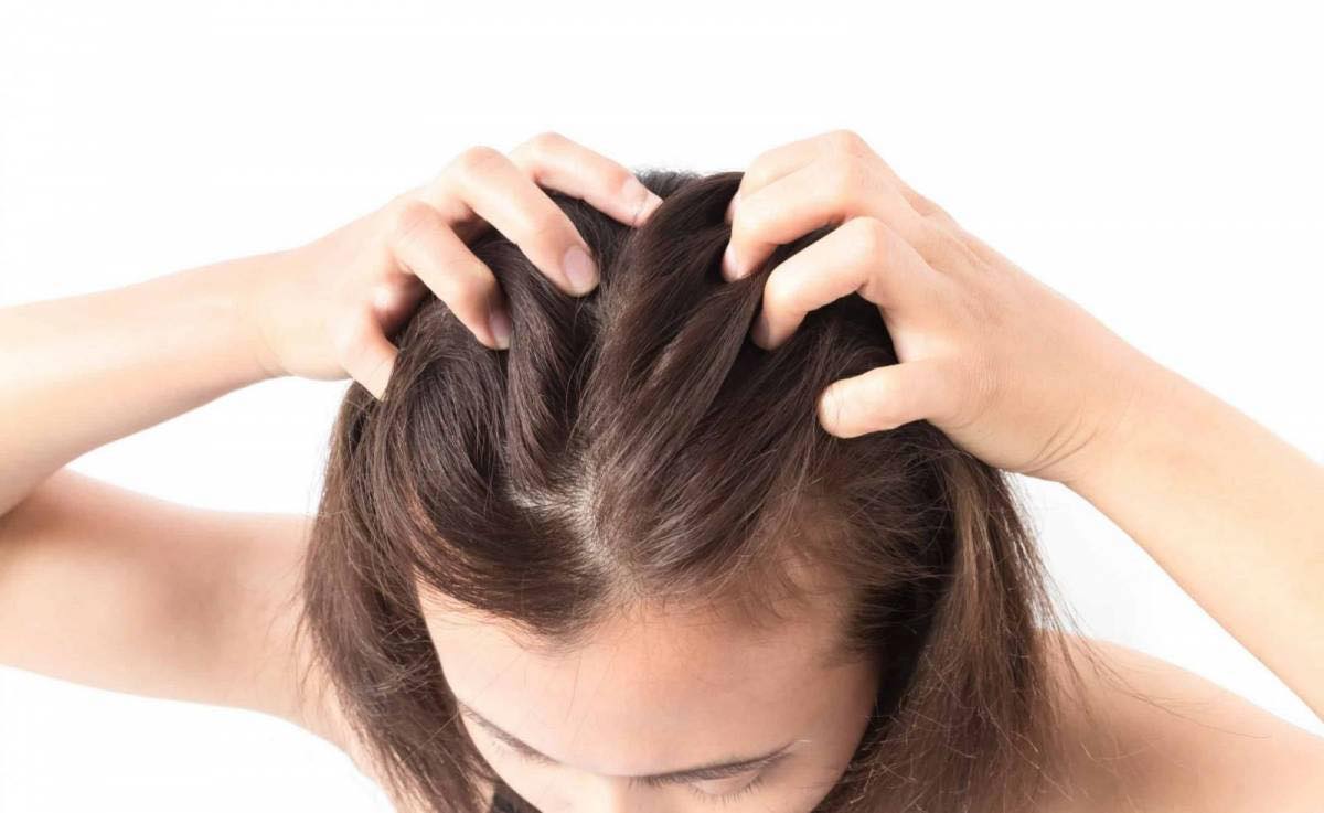 8 cách ngăn rụng tóc khi chuyển mùa, khắc phục nỗi ám ảnh mang tên “tóc rụng thành từng mảng” - Ảnh 4